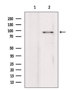 PIBF1 / PIBF Antibody - Western blot analysis of extracts of HepG2 cells using PIBF1 antibody. Lane 1 was treated with the blocking peptide.