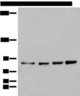 PIBF1 / PIBF Antibody - Western blot analysis of 293T Hela K562 and 231 cell lysates  using PIBF1 Polyclonal Antibody at dilution of 1:400