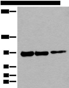 PIBF1 / PIBF Antibody - Western blot analysis of 293T cell lysates  using PIBF1 Polyclonal Antibody at dilution of 1:250