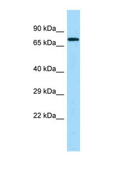 PICALM / CALM Antibody - PICALM antibody Western blot of Fetal Heart lysate. Antibody concentration 1 ug/ml.  This image was taken for the unconjugated form of this product. Other forms have not been tested.