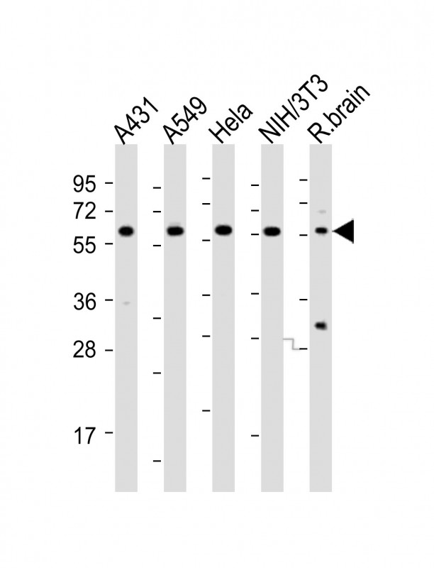 PICALM / CALM Antibody - All lanes: Anti-PICALM Antibody (Center) at 1:2000 dilution. Lane 1: A431 whole cell lysates. Lane 2: A549 whole cell lysates. Lane 3: HeLa whole cell lysates. Lane 4: NIH/3T3 whole cell lysates. Lane 5: rat brain lysates Lysates/proteins at 20 ug per lane. Secondary Goat Anti-Rabbit IgG, (H+L), Peroxidase conjugated at 1:10000 dilution. Predicted band size: 69 kDa. Blocking/Dilution buffer: 5% NFDM/TBST.