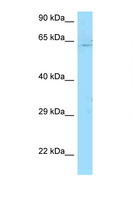 PICALM / CALM Antibody - PICALM antibody Western blot of Jurkat Cell lysate. Antibody concentration 1 ug/ml.  This image was taken for the unconjugated form of this product. Other forms have not been tested.