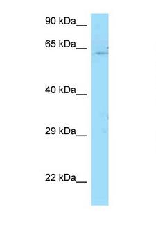 PICALM / CALM Antibody - PICALM antibody Western blot of Jurkat Cell lysate. Antibody concentration 1 ug/ml.  This image was taken for the unconjugated form of this product. Other forms have not been tested.