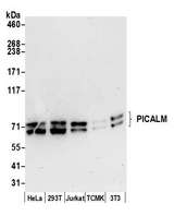 PICALM / CALM Antibody - Detection of human and mouse PICALM by western blot. Samples: Whole cell lysate (15 µg) from HeLa, HEK293T, Jurkat, mouse TCMK-1, and mouse NIH 3T3 cells prepared using NETN lysis buffer. Antibody: Affinity purified rabbit anti-PICALM antibody used for WB at 0.1 µg/ml. Detection: Chemiluminescence with an exposure time of 30 seconds.