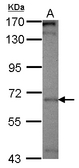 PICALM / CALM Antibody - Sample (30 ug of whole cell lysate) A: HepG2 7.5% SDS PAGE PICALM antibody diluted at 1:500