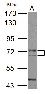 PICALM / CALM Antibody - Sample (30 ug of whole cell lysate) A: NIH-3T3 7.5% SDS PAGE PICALM antibody diluted at 1:1000