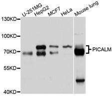 PICALM / CALM Antibody - Western blot analysis of extracts of various cell lines, using PICALM antibody at 1:1000 dilution. The secondary antibody used was an HRP Goat Anti-Rabbit IgG (H+L) at 1:10000 dilution. Lysates were loaded 25ug per lane and 3% nonfat dry milk in TBST was used for blocking. An ECL Kit was used for detection and the exposure time was 10s.