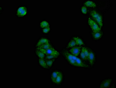 PICALM / CALM Antibody - Immunofluorescence staining of HepG2 cells at a dilution of 1:200, counter-stained with DAPI. The cells were fixed in 4% formaldehyde, permeabilized using 0.2% Triton X-100 and blocked in 10% normal Goat Serum. The cells were then incubated with the antibody overnight at 4 °C.The secondary antibody was Alexa Fluor 488-congugated AffiniPure Goat Anti-Rabbit IgG (H+L) .