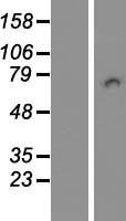 PICALM / CALM Protein - Western validation with an anti-DDK antibody * L: Control HEK293 lysate R: Over-expression lysate
