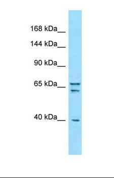 Piccolo Antibody - Western blot of Human Hela. PCLO antibody dilution 1.0 ug/ml.  This image was taken for the unconjugated form of this product. Other forms have not been tested.