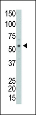 PICK1 Antibody - The anti-PRKCABP antibody is used in Western blot to detect PRKCABP in Y79 cell lysate.