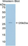 PICK1 Antibody - Western blot of recombinant PICK1.  This image was taken for the unconjugated form of this product. Other forms have not been tested.