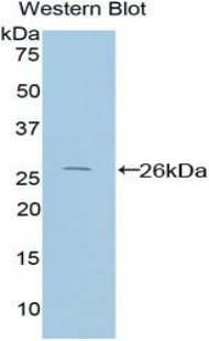 PICK1 Antibody - Western blot of recombinant PICK1.  This image was taken for the unconjugated form of this product. Other forms have not been tested.
