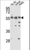 PICK1 Antibody - Western blot of hPRKCABP-C300 in HL-60, Jurkat, K562 cell line lysates (35 ug/lane). PRKCABP (arrow) was detected using the purified antibody.