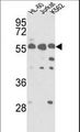 PICK1 Antibody - Western blot of hPRKCABP-C300 in HL-60, Jurkat, K562 cell line lysates (35 ug/lane). PRKCABP (arrow) was detected using the purified antibody.