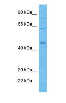 PICK1 Antibody - Western blot of PICK1 Antibody with human Jurkat Whole Cell lysate.  This image was taken for the unconjugated form of this product. Other forms have not been tested.