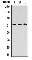 PICK1 Antibody - Western blot analysis of PICK1 expression in HEK293T (A); Raw264.7 (B); H9C2 (C) whole cell lysates.
