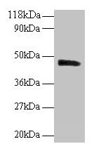 PICK1 Antibody - Western blot All lanes: PICK1 antibody at 2µg/ml + Mouse brain tissue Secondary Goat polyclonal to rabbit IgG at 1/10000 dilution Predicted band size: 47, 40 kDa Observed band size: 47 kDa