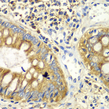 PICK1 Antibody - Immunohistochemistry of paraffin-embedded human colon tissue.
