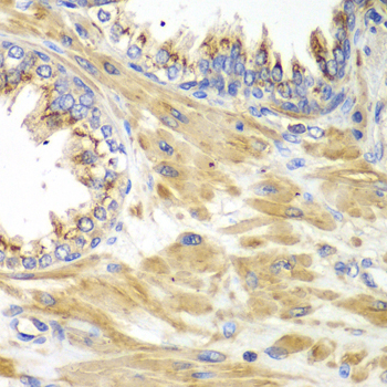 PICK1 Antibody - Immunohistochemistry of paraffin-embedded human prostate.