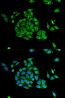 PICK1 Antibody - Immunofluorescence analysis of HeLa cells.