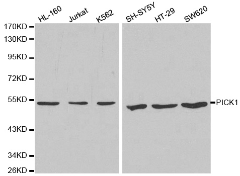 PICK1 Antibody - Western blot analysis of extracts of various cell lines, using PICK1 antibody at 1:1000 dilution. The secondary antibody used was an HRP Goat Anti-Rabbit IgG (H+L) at 1:10000 dilution. Lysates were loaded 25ug per lane and 3% nonfat dry milk in TBST was used for blocking.