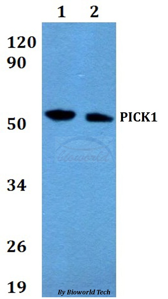 PICK1 Antibody - Western blot of PICK1 antibody at 1:500 dilution. Lane 1: HEK293T whole cell lysate. Lane 2: Raw264.7 whole cell lysate. Lane 3: H9C2 whole cell lysate.