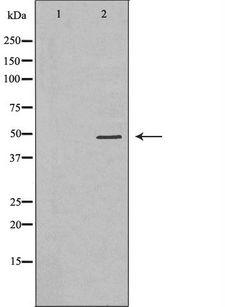 PICK1 Antibody - Western blot analysis of rat brain lysates using PICK1 antibody. The lane on the left is treated with the antigen-specific peptide.