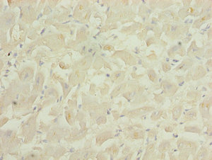 PID1 Antibody - Immunohistochemistry of paraffin-embedded human heart tissue using PID1 Antibody at dilution of 1:100