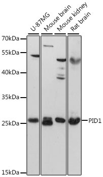 PID1 Antibody - Western blot analysis of extracts of various cell lines, using PID1 antibody at 1:3000 dilution. The secondary antibody used was an HRP Goat Anti-Rabbit IgG (H+L) at 1:10000 dilution. Lysates were loaded 25ug per lane and 3% nonfat dry milk in TBST was used for blocking. An ECL Kit was used for detection and the exposure time was 30s.