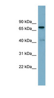 PIDD1 Antibody - LRDD antibody Western blot of Fetal Liver lysate. This image was taken for the unconjugated form of this product. Other forms have not been tested.