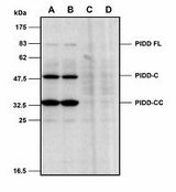 PIDD1 Antibody - Mouse PIDD is detected in primary MEF cells using anti-PIDD (mouse), mAb (Lise-1) . Method:: Cell extracts from mouse embryo fibroblasts (MEFs) either from WT (A-B) or PIDD KO cells (C-D) were separated by SDS-PAGE under reducing conditions, transferred to nitrocellulose and incubated with anti-PIDD (mouse), mAb (Lise-1) (1ug/ml). Proteins were visualized by a chemiluminescence detection system.