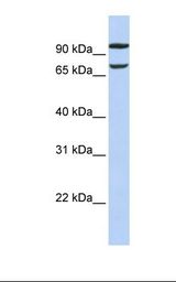 PIEZO2 / FAM38B Antibody - 721_B cell lysate. Antibody concentration: 1.0 ug/ml. Gel concentration: 12%.  This image was taken for the unconjugated form of this product. Other forms have not been tested.