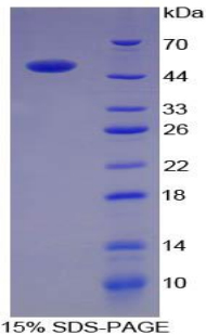 ACE / CD143 Protein - Recombinant Angiotensin I Converting Enzyme By SDS-PAGE