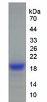 ANGPTL4 Protein - Recombinant Angiopoietin Like Protein 4 By SDS-PAGE