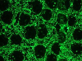 Mouse IgG Antibody - Mouse IgG was used in a 1:25 dilution on swine colon, in combination with the primary monoclonal antibody to vimentin, RV202 (Vimentin), used in a 1:1000 dilution. The green staining shows the connective tissue cells, while no staining is seen in the epithelial cells of the intestinal crypts.