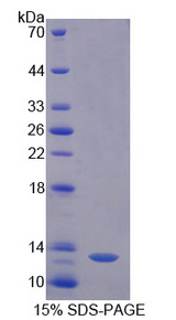 AOC1 Protein - Recombinant Diamine Oxidase By SDS-PAGE