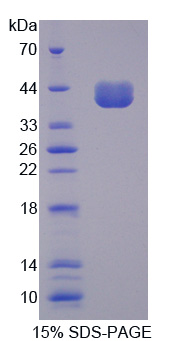 CD14 Protein - Recombinant Cluster Of Differentiation 14 By SDS-PAGE