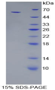 CDH1 / E Cadherin Protein - Recombinant Cadherin, Epithelial By SDS-PAGE