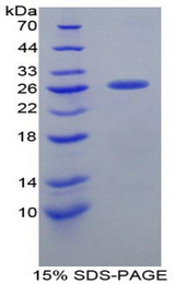 CLU / Clusterin Protein - Recombinant Clusterin By SDS-PAGE