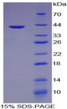 Complement C3a Protein - Recombinant Complement Component 3a By SDS-PAGE