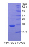 CRBPIV / RBP7 Protein - Recombinant Retinol Binding Protein 7, Cellular By SDS-PAGE