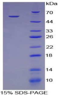 CTSK / Cathepsin K Protein - Recombinant Cathepsin K By SDS-PAGE