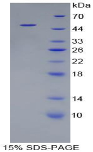CTSL / Cathepsin L Protein - Recombinant Cathepsin L By SDS-PAGE