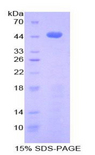 CXCL7 / PPBP Protein - Recombinant Beta-Thromboglobulin By SDS-PAGE