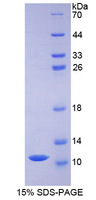 DEFB1 / BD-1 Protein - Recombinant Defensin Beta 1 By SDS-PAGE