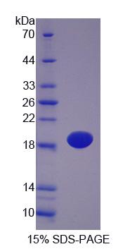 E-FABP / FABP5 Protein - Recombinant  Fatty Acid Binding Protein 5, Epidermal By SDS-PAGE