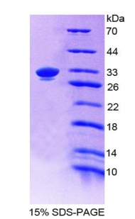 EPCAM Protein - Recombinant  Epithelial Cell Adhesion Molecule By SDS-PAGE