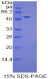 EPO / Erythropoietin Protein - Recombinant Erythropoietin By SDS-PAGE