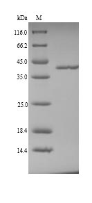 F12 / Factor XII Protein - (Tris-Glycine gel) Discontinuous SDS-PAGE (reduced) with 5% enrichment gel and 15% separation gel.
